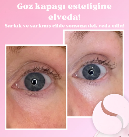 Instalift™ PDRN & Kolajen Göz Altı Patchleri